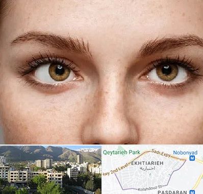 متخصص انحراف چشم در اختیاریه 