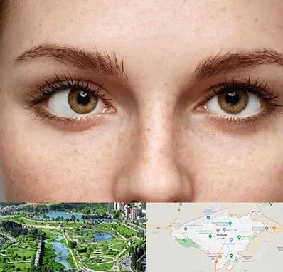 متخصص انحراف چشم در بجنورد