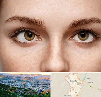 متخصص انحراف چشم در سنندج