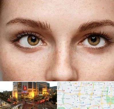 متخصص انحراف چشم در جنت آباد تهران 