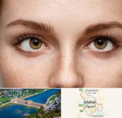 متخصص انحراف چشم در اصفهان