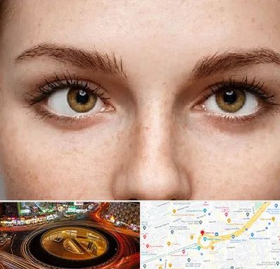 متخصص انحراف چشم در میدان ولیعصر 