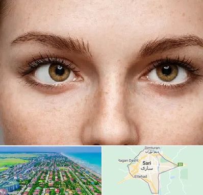 متخصص انحراف چشم در ساری