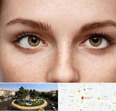 متخصص انحراف چشم در هفت حوض 