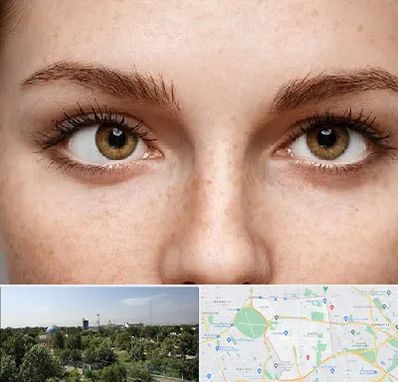 متخصص انحراف چشم در منطقه 16 تهران 