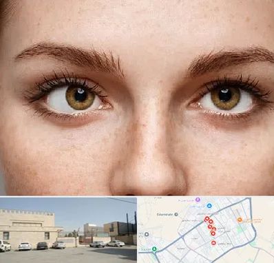 متخصص انحراف چشم در نواب اسلامشهر