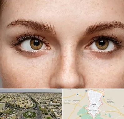 متخصص انحراف چشم در قزوین