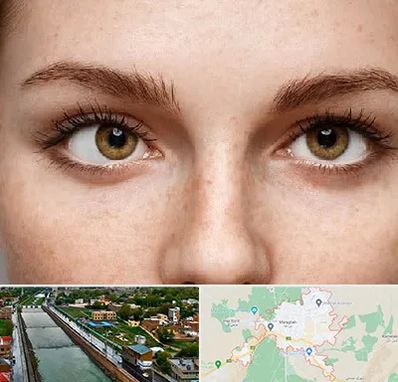 متخصص انحراف چشم در مراغه