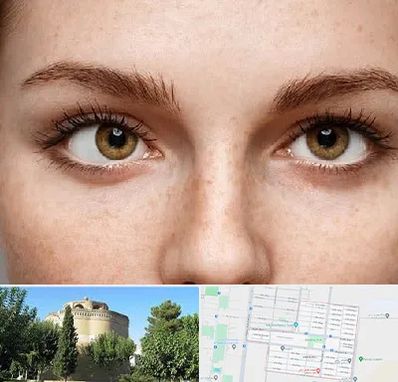 متخصص انحراف چشم در مرداویج اصفهان