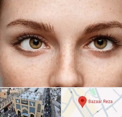 متخصص انحراف چشم در بازار رضا مشهد