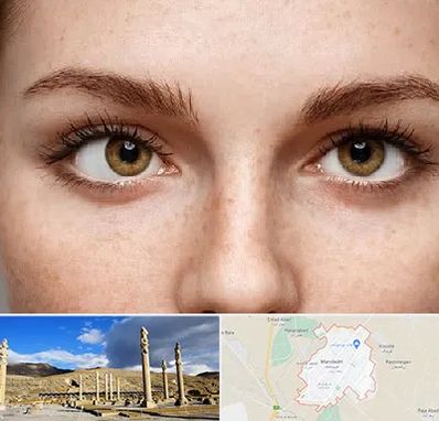 متخصص انحراف چشم در مرودشت