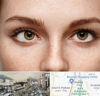 متخصص انحراف چشم در پونک 