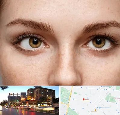 متخصص انحراف چشم در بلوار سجاد مشهد 