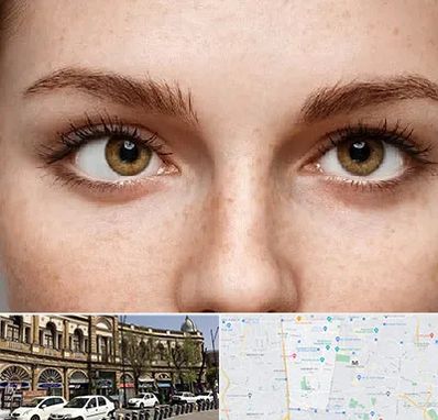 متخصص انحراف چشم در منطقه 11 تهران 