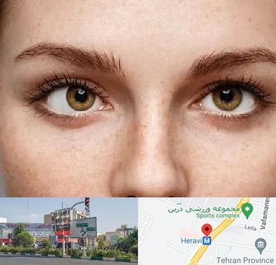 متخصص انحراف چشم در هروی 