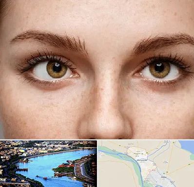 متخصص انحراف چشم در خرمشهر