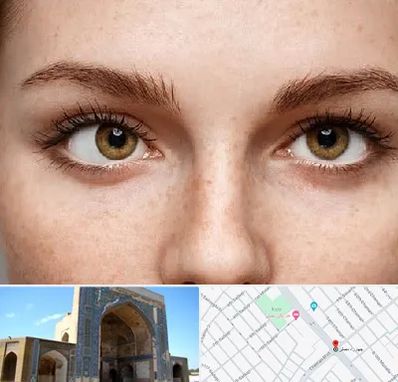 متخصص انحراف چشم در مصلی مشهد