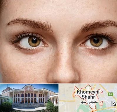 متخصص انحراف چشم در خمینی شهر