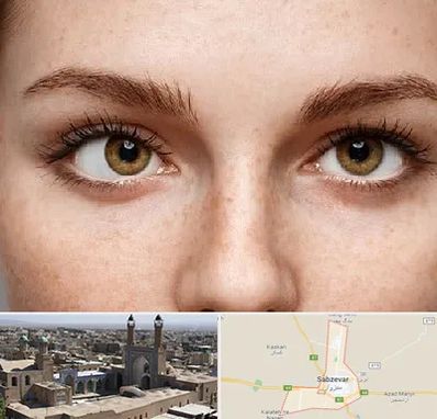 متخصص انحراف چشم در سبزوار