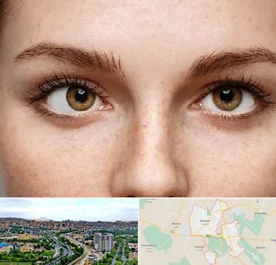 متخصص انحراف چشم در شهریار