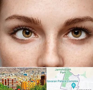 متخصص انحراف چشم در نیاوران 