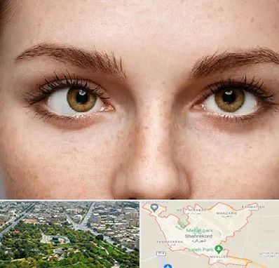 متخصص انحراف چشم در شهرکرد