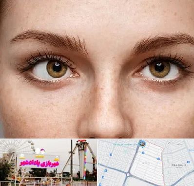متخصص انحراف چشم در پادادشهر اهواز