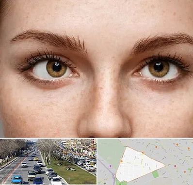 متخصص انحراف چشم در احمدآباد مشهد 