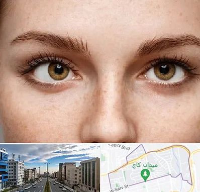 متخصص انحراف چشم در سعادت آباد 