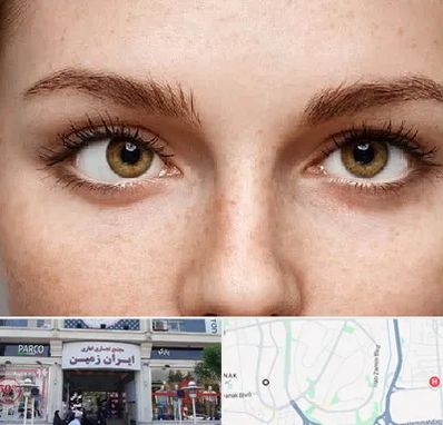 متخصص انحراف چشم در ایران زمین