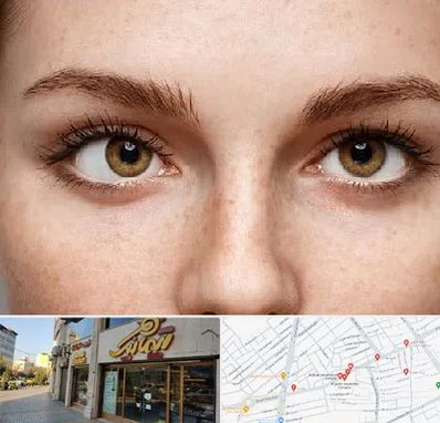 متخصص انحراف چشم در عطاران قم