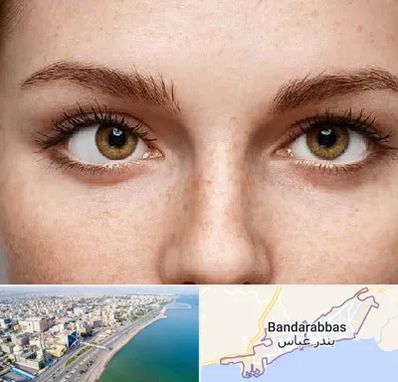 متخصص انحراف چشم در بندرعباس