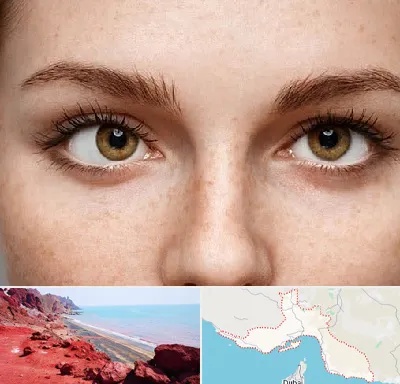 متخصص انحراف چشم در هرمزگان