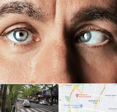 فوق تخصص استرابیسم در ظفر 