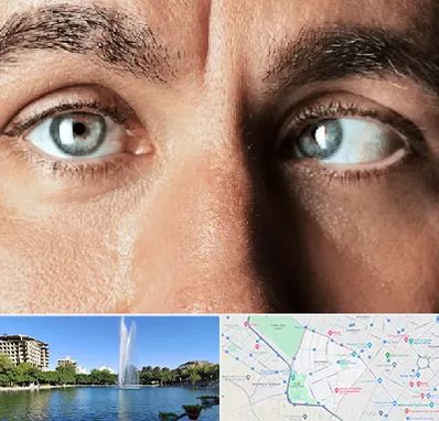 فوق تخصص استرابیسم در کوهسنگی مشهد