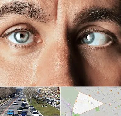 فوق تخصص استرابیسم در احمدآباد مشهد 