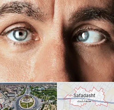 فوق تخصص استرابیسم در صفادشت