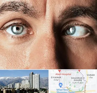 فوق تخصص استرابیسم در شهرک غرب 