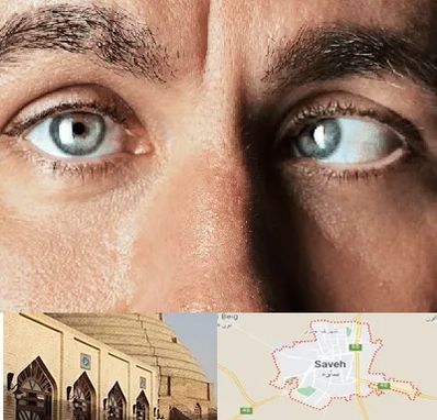 فوق تخصص استرابیسم در ساوه