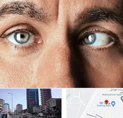 فوق تخصص استرابیسم در چهارراه طالقانی کرج