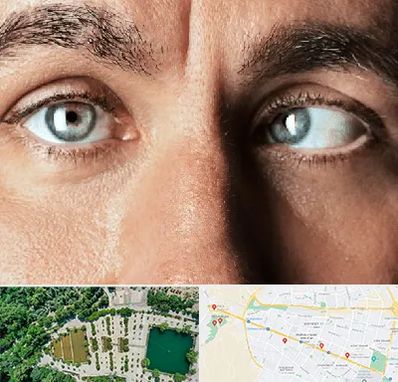 فوق تخصص استرابیسم در وکیل آباد مشهد 