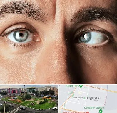 فوق تخصص استرابیسم در تهرانسر 