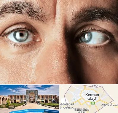 فوق تخصص استرابیسم در کرمان