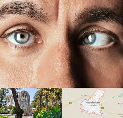 فوق تخصص استرابیسم در نیشابور