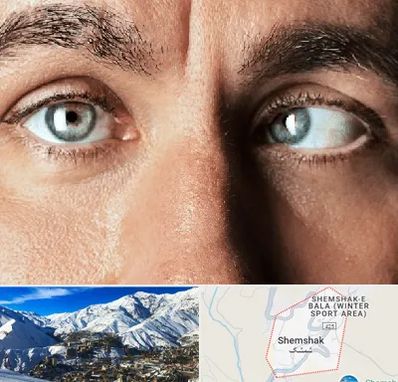 فوق تخصص استرابیسم در شمشک