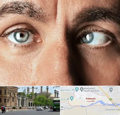 فوق تخصص استرابیسم در پاکدشت