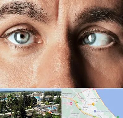 فوق تخصص استرابیسم در رودسر