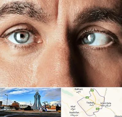 فوق تخصص استرابیسم در تایباد