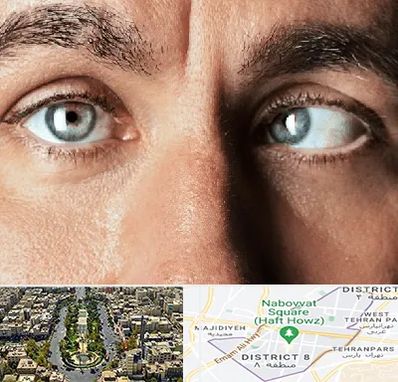 فوق تخصص استرابیسم در نارمک 