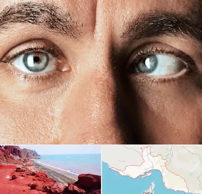 فوق تخصص استرابیسم در هرمزگان